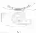 Fig. 05 - SOUND PRODUCTION APPARATUS AND ELECTRONIC DEVICE
