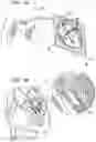 Fig. 02 - Helical anchor implantation