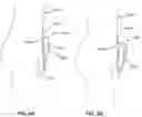 Fig. 10 - MALE FLUID COLLECTION ASSEMBLIES AND SYSTEMS, METHODS OF USING, AND METHODS OF MANUFACTURING THE SAME