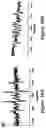 Fig. 22 - Laser induced collagen crosslinking in tissue