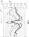 Fig. 14 - Uniformity control circuit for impedance match