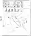 Fig. 35 - Surgical system for positioning prosthetic component and/or for constraining movement of surgical tool