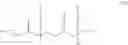 Fig. 119 - PROCESS FOR PREPARING CARBOXYLIC ACID ESTER-CROSS-LINKED POLYGLYCEROL ESTERS OF 3-HYDROXYBUTYRIC ACID