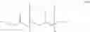 Fig. 126 - PROCESS FOR PREPARING CARBOXYLIC ACID ESTER-CROSS-LINKED POLYGLYCEROL ESTERS OF 3-HYDROXYBUTYRIC ACID