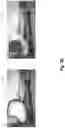 Fig. 07 - Learning parameters for generative inpainting neural networks utilizing object-aware training and masked regularization