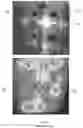 Fig. 04 - DEVICE FOR HEATING A MATERIAL USING MICROWAVES, METHOD FOR HEATING A MATERIAL USING MICROWAVES, AND SYSTEMS FOR HEATING A MATERIAL USING MICROWAVES