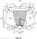 Fig. 02 - Filtered garment