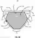 Fig. 06 - Filtered garment