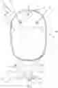 Fig. 02 - AN OSTOMY APPLIANCE