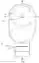 Fig. 04 - AN OSTOMY APPLIANCE