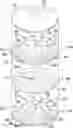 Fig. 01 - Odor filtering lid assembly