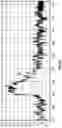 Fig. 08 - Spectrographic Tooth Evaluation System