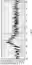 Fig. 10 - Spectrographic Tooth Evaluation System