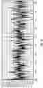 Fig. 11 - Spectrographic Tooth Evaluation System