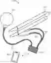 Fig. 01 - IMPLANTABLE INFLATABLE DEVICE AND THERAPEUTIC METHODS