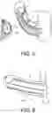 Fig. 06 - IMPLANTABLE INFLATABLE DEVICE AND THERAPEUTIC METHODS