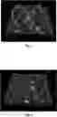 Fig. 04 - Light emitting diode and display device