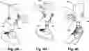 Fig. 05 - PROSTHETIC SOCKET RELEASE/RELOCK SYSTEM