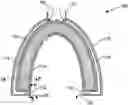 Fig. 01 - BREATHING ASSIST DEVICE