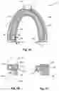 Fig. 02 - BREATHING ASSIST DEVICE