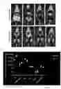 Fig. 02 - A NOVEL MUSCLE-SPECIFIC PROMOTER