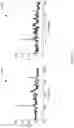 Fig. 04 - Optical Coherence Tomography With Self-Inspecting Imaging Device