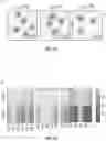 Fig. 06 - IDENTIFICATION OF LOW-DENSITY INFLAMMATORY NEUTROPHILS IN SEVERE COVID-19 PATIENTS