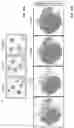 Fig. 33 - IDENTIFICATION OF LOW-DENSITY INFLAMMATORY NEUTROPHILS IN SEVERE COVID-19 PATIENTS