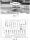 Fig. 07 - Method and apparatus for contactless voltage and current estimation through measurements of electric and magnetic fields with redundant sensor arrays