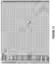 Fig. 12 - MULTITIER CLASSIFICATION SCHEME FOR COMPREHENSIVE DETERMINATION OF CANCER PRESENCE AND TYPE BASED ON ANALYSIS OF GENETIC INFORMATION AND SYSTEMS FOR IMPLEMENTING THE SAME