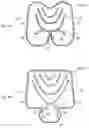 Fig. 05 - Air cushion