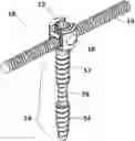 Fig. 01 - Bone Fixation System for Spinal Stabilization