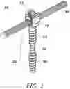 Fig. 02 - Bone Fixation System for Spinal Stabilization