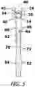 Fig. 05 - Bone Fixation System for Spinal Stabilization