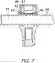 Fig. 07 - Bone Fixation System for Spinal Stabilization