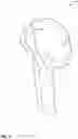 Fig. 03 - HUMERUS ANATOMICAL NECK DETECTION FOR SHOULDER REPLACEMENT PLANNING