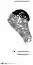Fig. 11 - HUMERUS ANATOMICAL NECK DETECTION FOR SHOULDER REPLACEMENT PLANNING