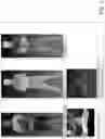 Fig. 03 - MOTION COMPRESSION FOR EFFICIENT DYNAMIC MESH CODING
