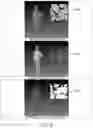 Fig. 07 - MOTION COMPRESSION FOR EFFICIENT DYNAMIC MESH CODING