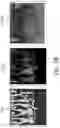 Fig. 27 - MOTION COMPRESSION FOR EFFICIENT DYNAMIC MESH CODING