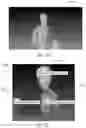 Fig. 33 - MOTION COMPRESSION FOR EFFICIENT DYNAMIC MESH CODING