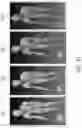 Fig. 37 - MOTION COMPRESSION FOR EFFICIENT DYNAMIC MESH CODING