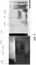 Fig. 08 - Solar blind imaging