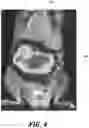 Fig. 06 - IN VIVO SCREENING ARRAY
