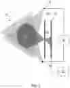 Fig. 02 - BACKSCATTERED X-PHOTON IMAGING DEVICE