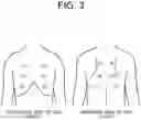 Fig. 04 - LUNG SOUND ANALYSIS SYSTEM