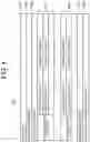 Fig. 05 - LUNG SOUND ANALYSIS SYSTEM