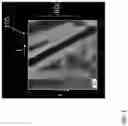 Fig. 02 - Elastography device and method