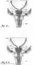Fig. 12 - Devices, systems and methods for treating benign prostatic hyperplasia and other conditions