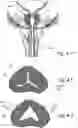 Fig. 16 - Devices, systems and methods for treating benign prostatic hyperplasia and other conditions